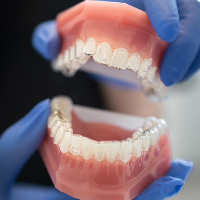 invisalignclearaligners