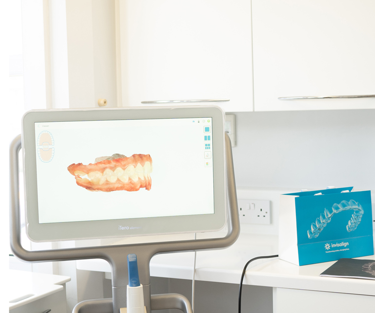 Invisalign_itero